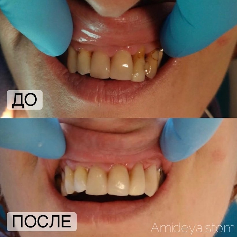 Фото работ стоматологии Амидея