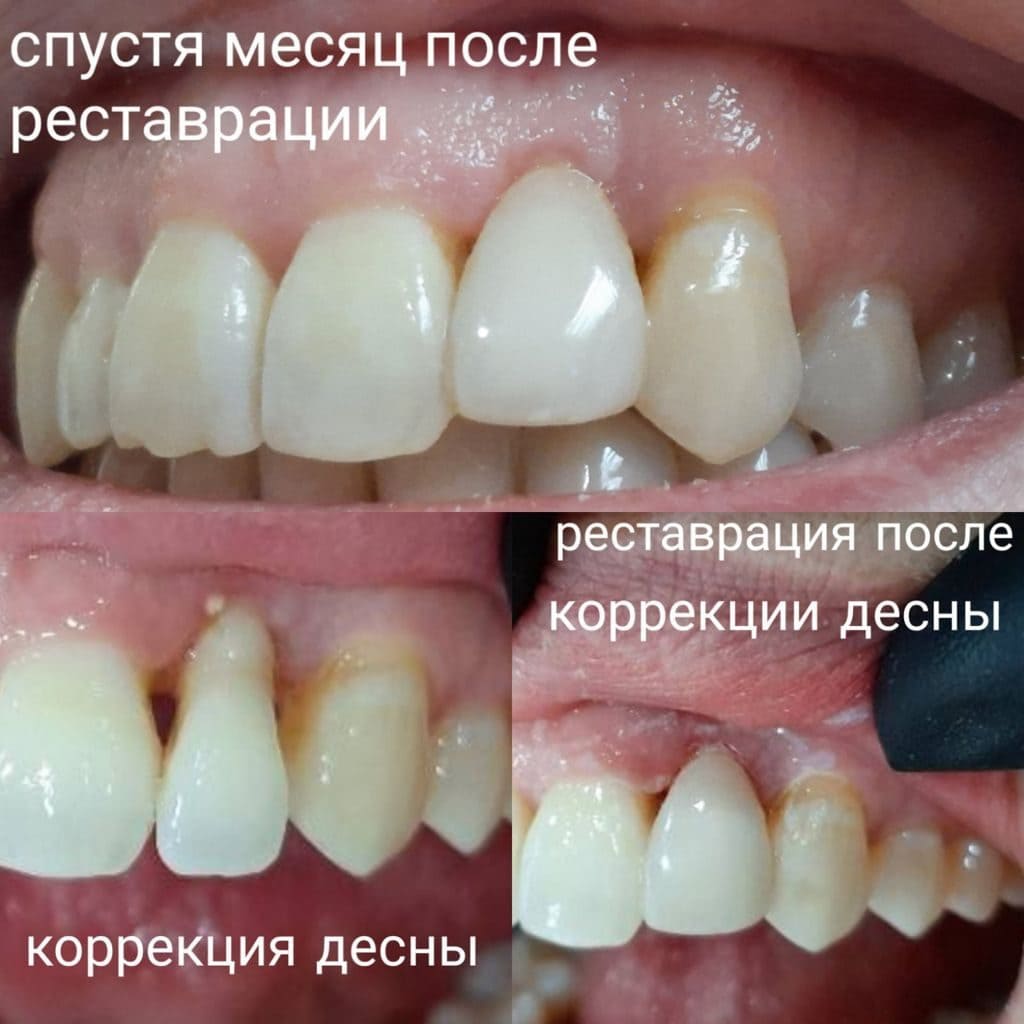 Фото работ стоматологии Амидея